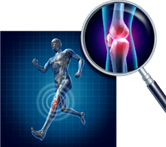 Arthroza kolenskega sklepa